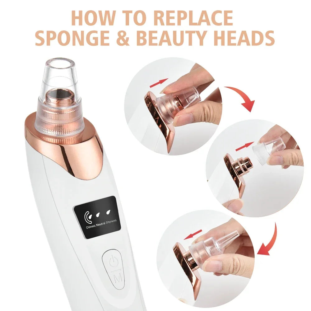 BLACK HEADS ACNE OIL REMOVER 5 in 1