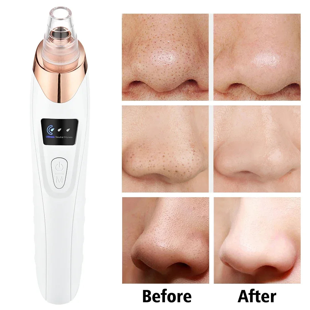 BLACK HEADSREMOVAL MACHINE 5-IN-1